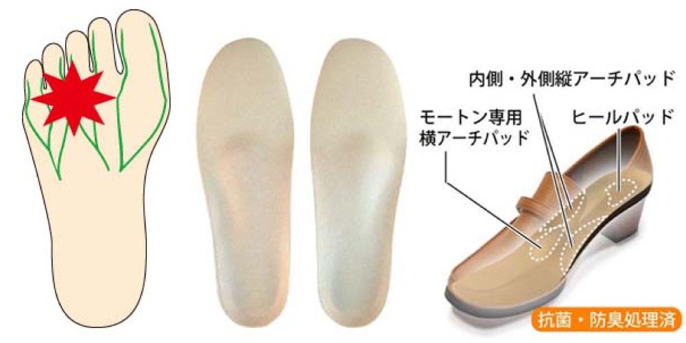 Insole Pro (shoe insoles) Morton's disease prevention for ladies L (24~25cm)