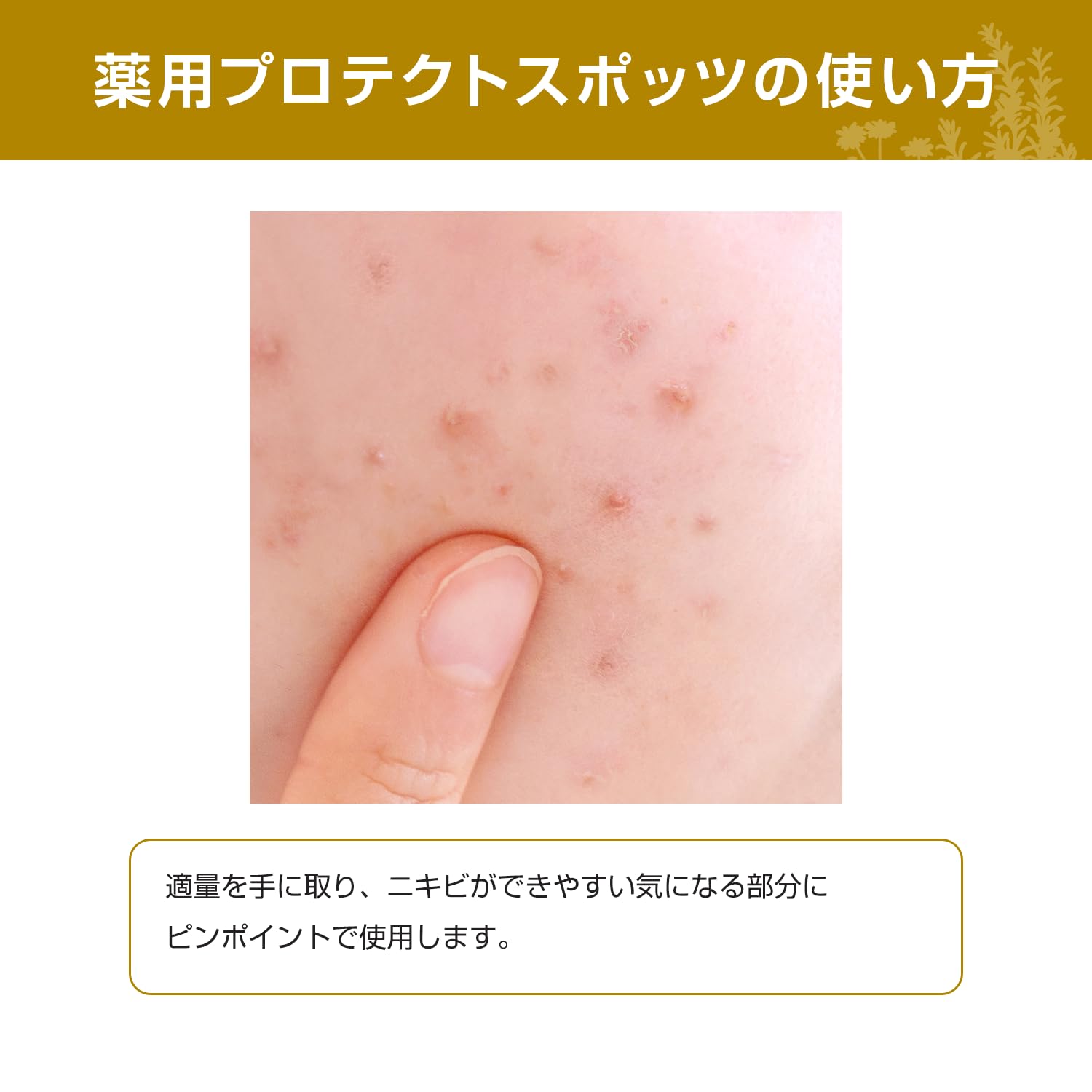 Acne Barrier Medicated Protect Spots Adult Acne Mask Rough Prevention Herb Tea Tree Quasi-drug Serum 30mL