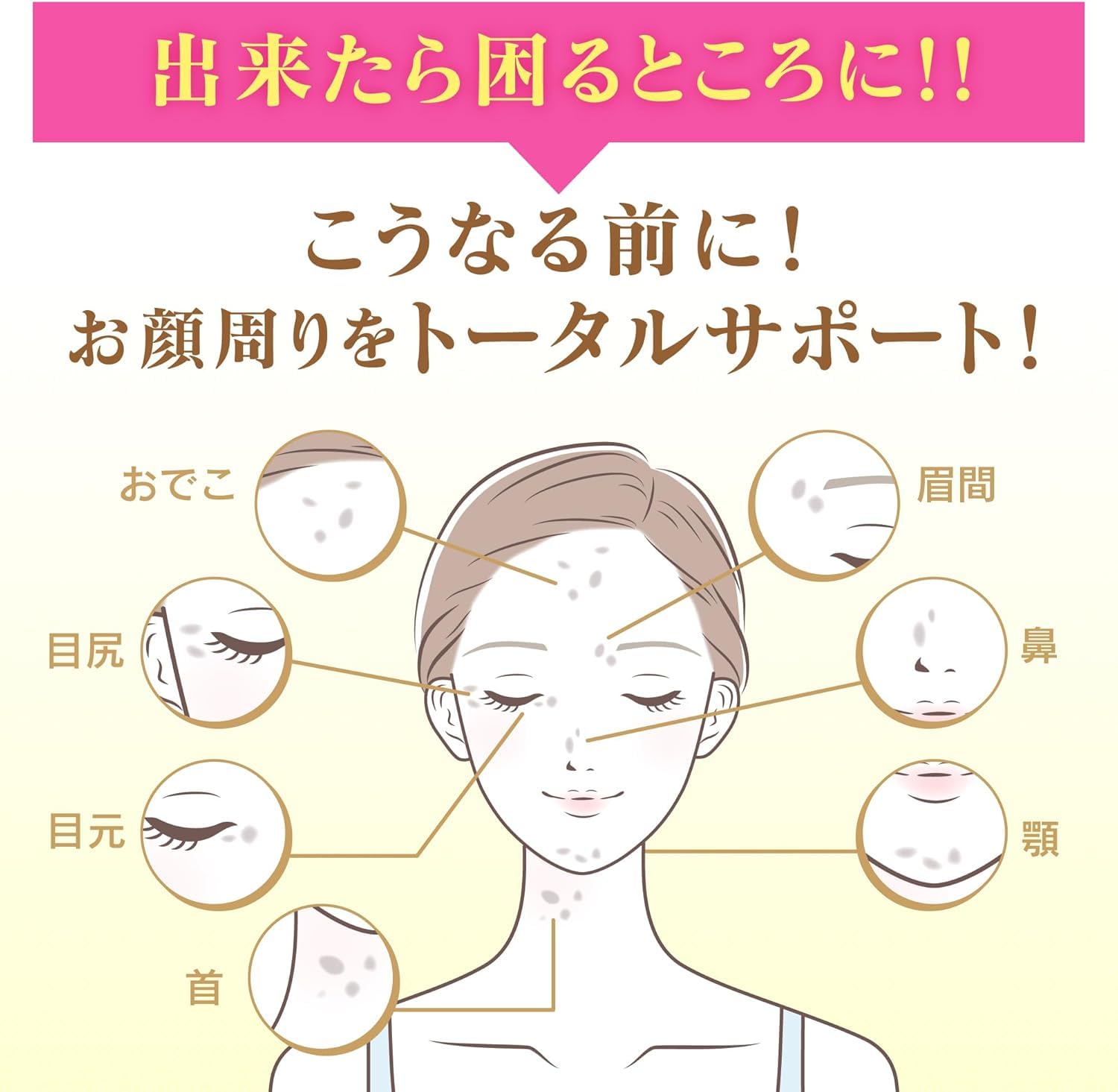 [ 케시민 ] 케시민 밀봉 유액 본체 【 비타민 C 유도체와 V 화이트 C 배합 】 【 기미 주근깨 의 예방 에 ! 】 케시민 [ 고바야시 제약 ] 의약 부외품