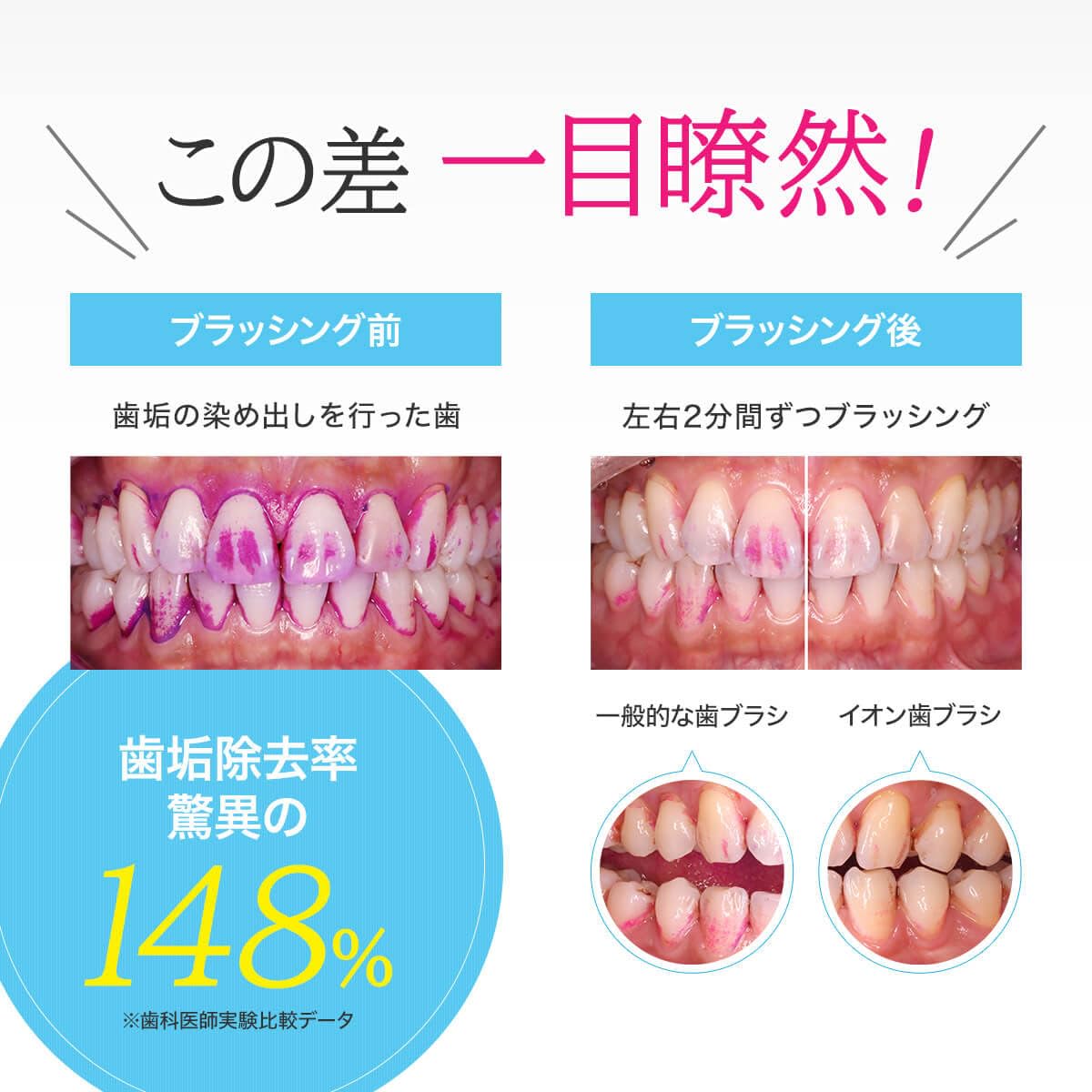 KISS YOU Ion Toothbrush Extra Fine Slim Soft Replacement Brush (2 pieces) *Color cannot be selected