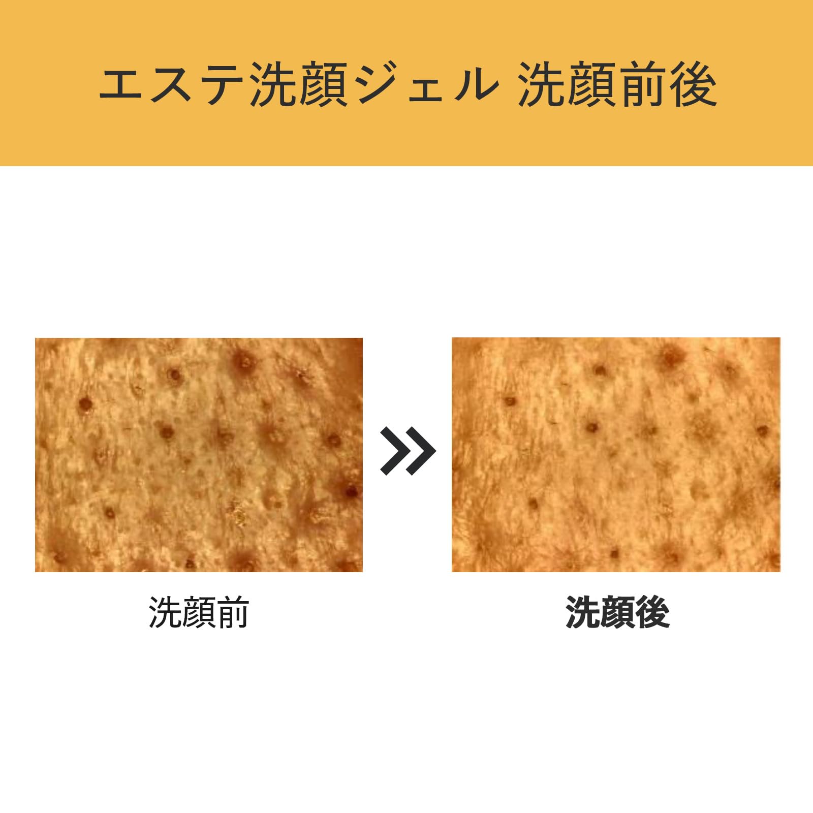 아쿠아 레이블 세안 에스테틱 세안 젤 130g 각전 분해 처방 모공 케어 세안 메이크업 떨어뜨림 AQUALABEL