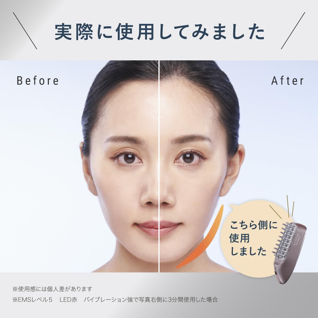 두개골 D 보테 두개골 전기 브러쉬 의사 감수