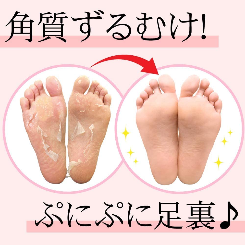 Gói lột da chân Perorin Rose 2 lần