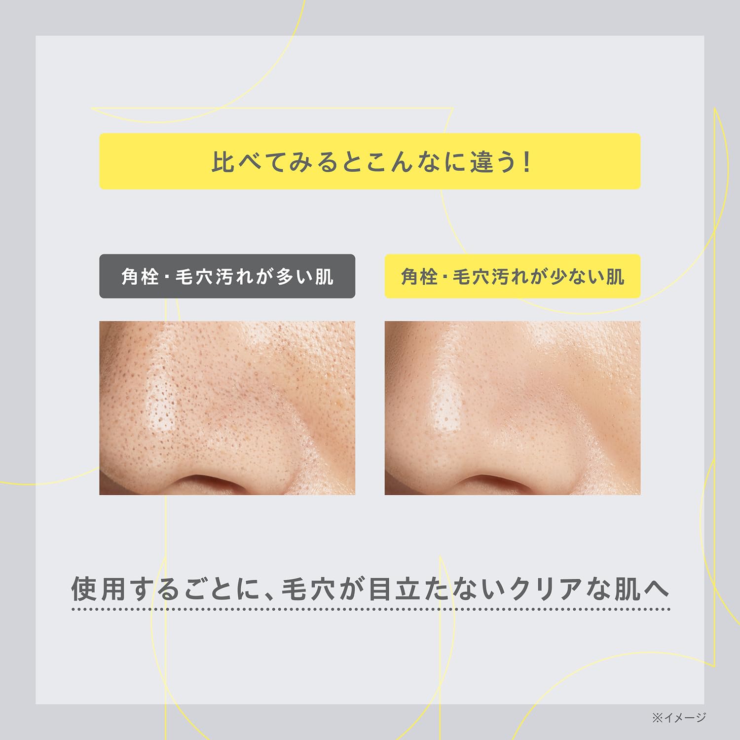 ONE BY KOSE Wipe-off Serum Pore Clear Peel Serum Body 120mL Corner Plug Dead Skin Moisturizing Vitamin E Derivative Hyaluronic Acid Glycerin