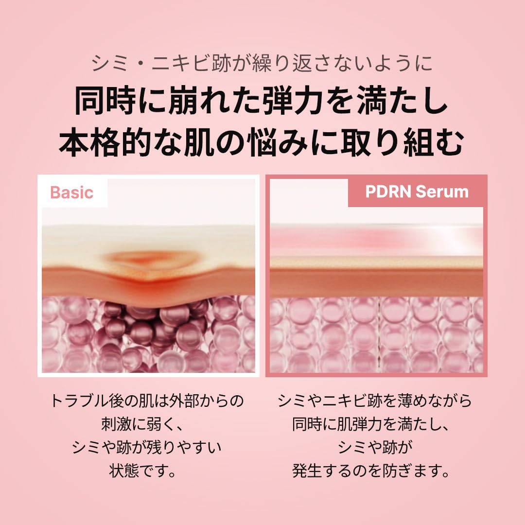 메디큐브 PDRN 핑크 앰플 10,000ppm 배합 미용액 연어 주사 저자극 저울 한국화장품 medicube pink peptide serum