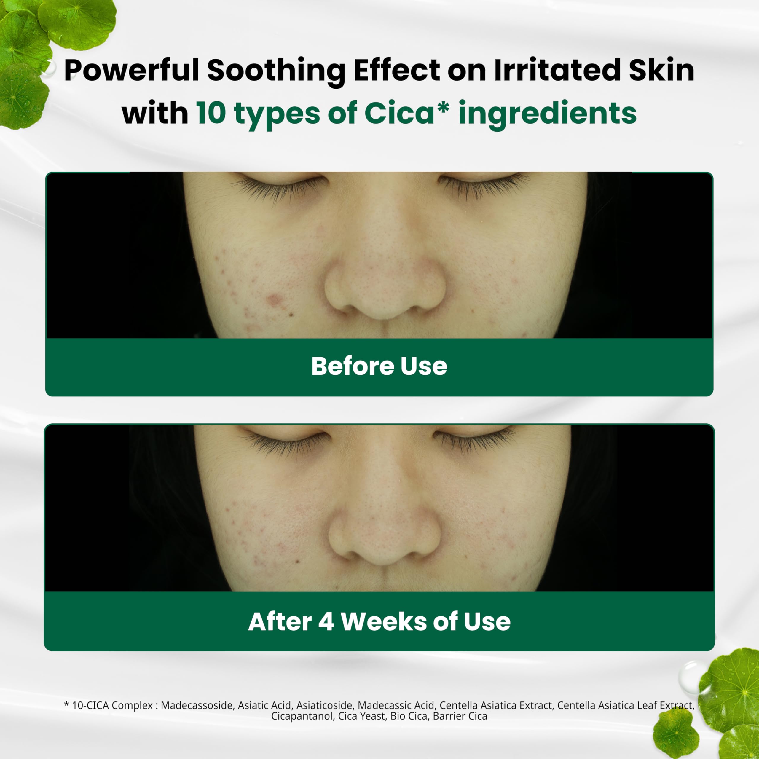 Dr.G R.E.D BLEMISH Clear Soothing Cream (50mL)