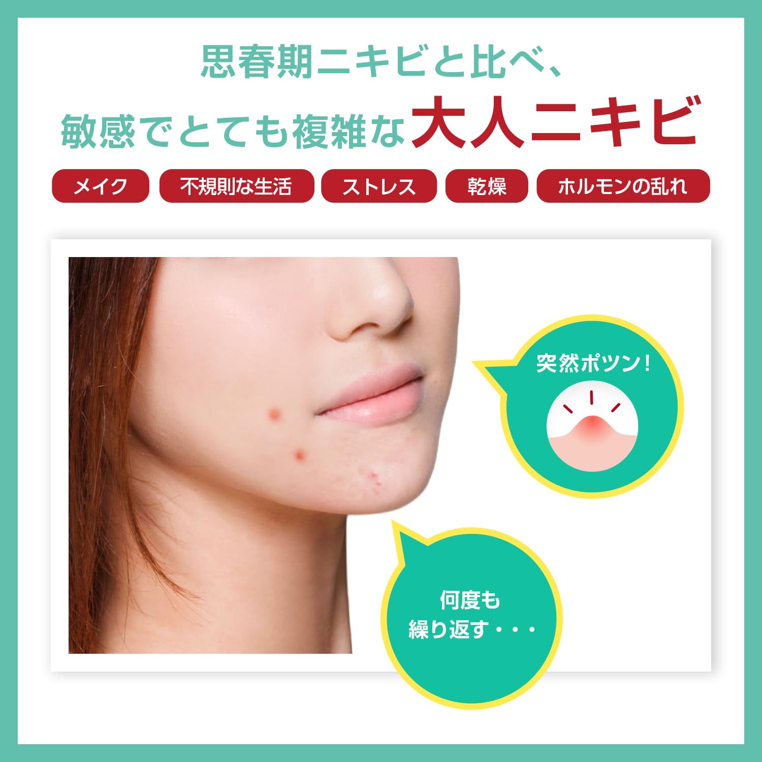 Acne Barrier Medicated Protect Spots Adult Acne Mask Rough Prevention Herb Tea Tree Quasi-drug Serum 30mL