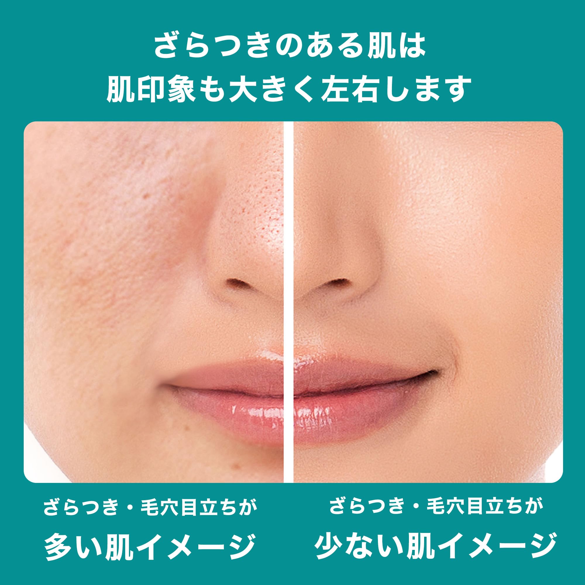 La Roche-Posay (라로슈 포제) 에파쿠라 필 케어 세럼 30ml 각질 케어 모공 케어